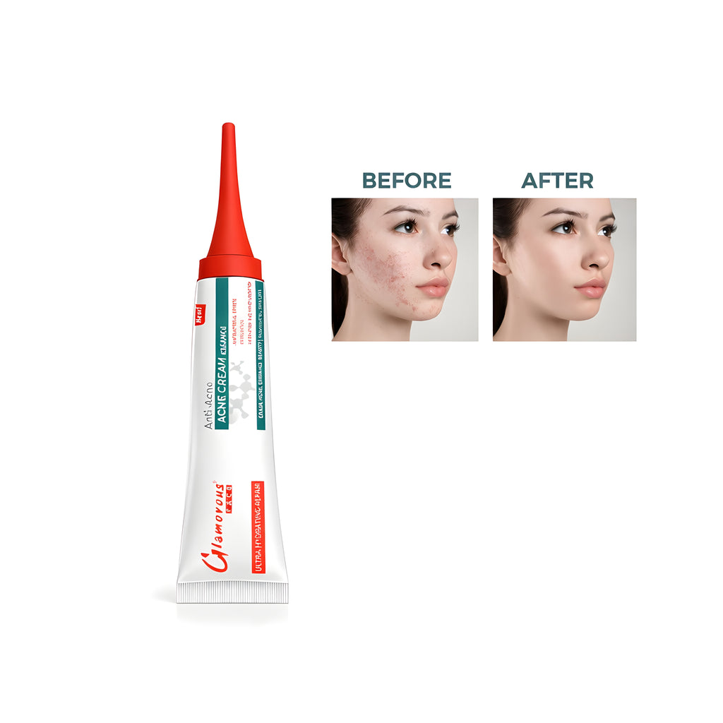 GLAMOROUS FACE ACNE CREAM ESSENCE
